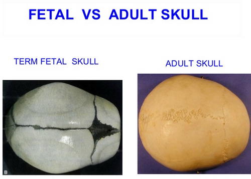 A comparison image between a fetal skull and an adult skull image photo picture