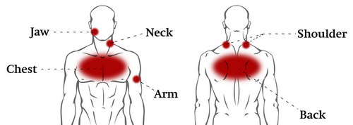 Network of chest pain in human body
